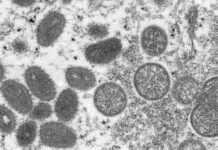 Hai ca nhiễm đậu mùa khỉ đầu tiên tại Iceland